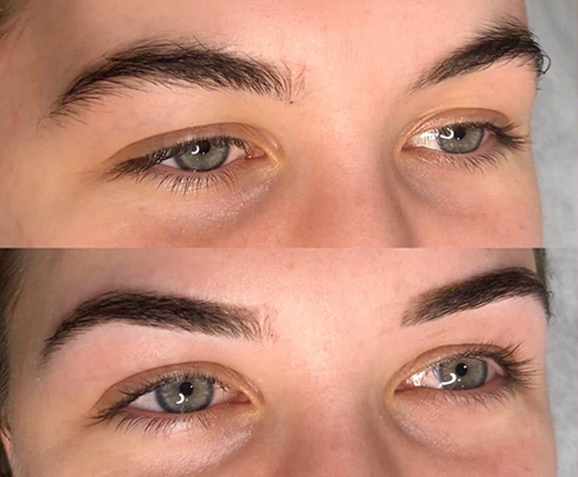 One of Sydney s Most Experienced Cosmetic Tattooing Eyebrow